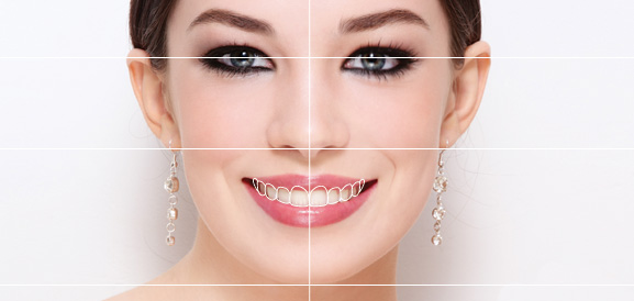 Digital Smile Design (DSD)